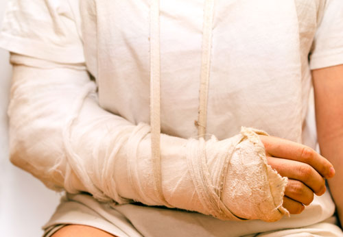 Personal Injury Lawyer San Fernando Valley